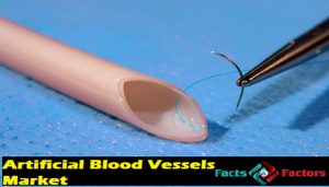 Global Artificial Blood Vessels Market